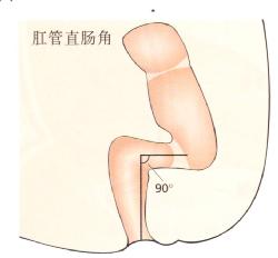 肛管直肠角
