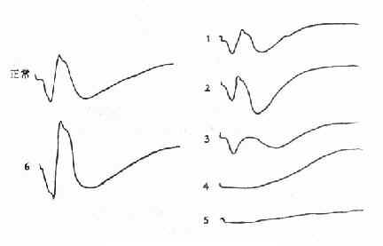 《西医眼科学》_第三节 眼的特殊检查_中医世