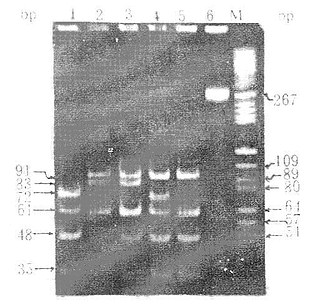 ApoE基因PCR产物HhaⅠ酶切后RFLP图谱