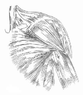 锁骨骨折近端向上、向后移位,远端向内、向下移位