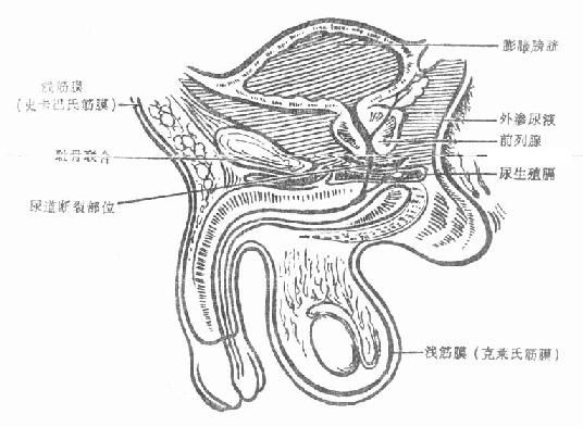 尿道膜部创伤尿外渗范围