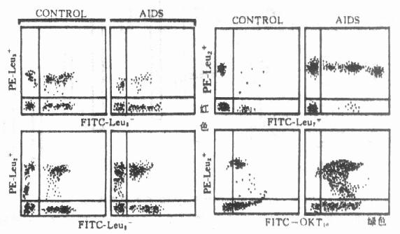 健康人艾滋病人淋巴细胞表面抗原的比较