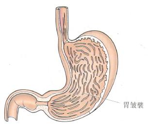 胃粘膜形成的胃皱襞示意图