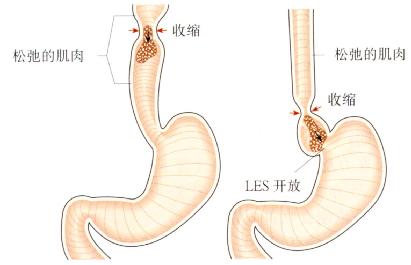 食团沿食管向下推进