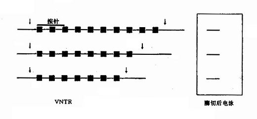 VNTR导致的RFLP重复次数的变异致酶切位点的移动和DNA片段长度的变异