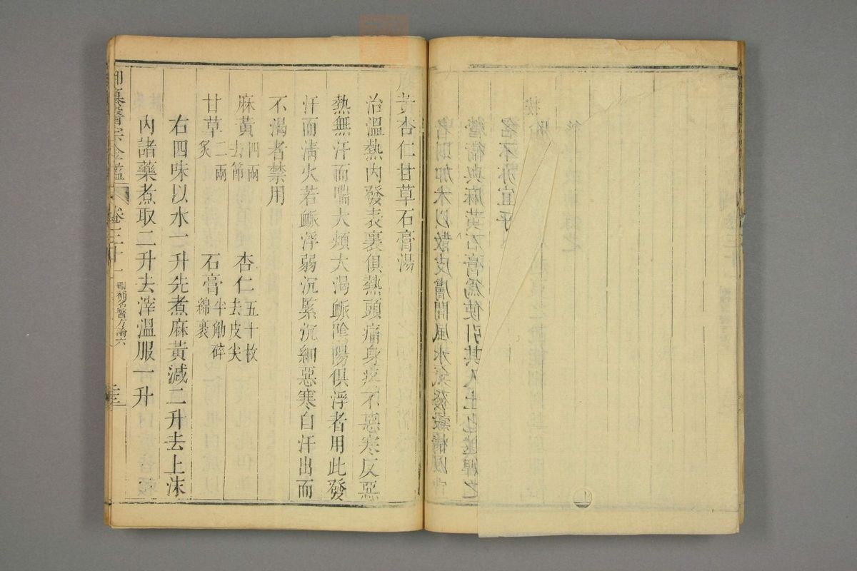 御纂医宗金鉴(第1541页)