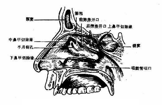 鼻腔外侧壁（上、中、下鼻甲部分去除）