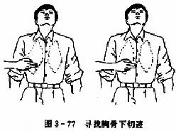 胸外心脏按压术：寻找胸骨下切迹