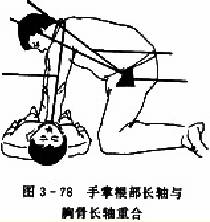 胸外心脏按压术：手掌根部长轴与胸骨长轴重合