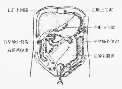 腹膜腔间隙的沟通