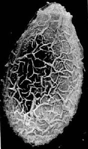 华支睾吸虫卵扫描电镜图