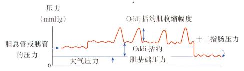 与测压记录相关的Oddi括约肌压力示意