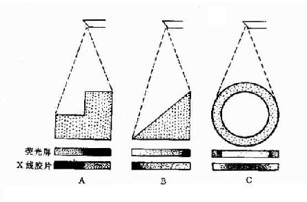 不同厚度组织（密度相同）与X线成像的关系