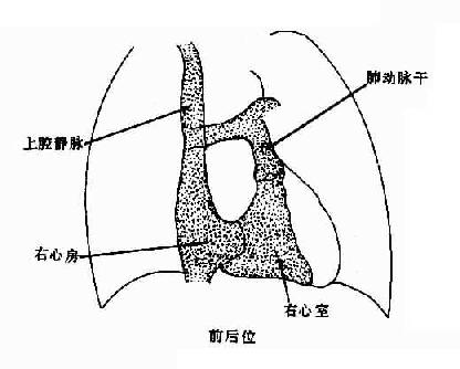 正常腔静脉，右心房、室造影示意图