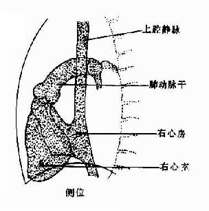 正常腔静脉，右心房、室造影示意图