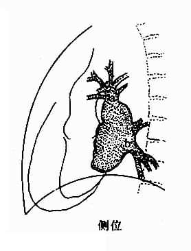 正常肺静脉、左心房造影示意图