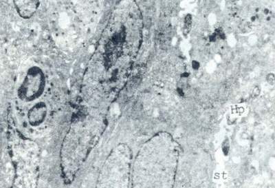 Hp钻入壁细胞的分泌小管中超薄切片,透射电镜